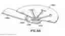 Fig. 77 - Patch-like infusion device