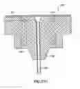 Fig. 88 - Patch-like infusion device