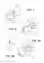 Fig. 04 - Devices and methods for the treatment of metabolic disorders