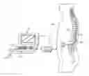 Fig. 01 - User interface with view finder for localizing anatomical region
