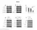 Fig. 09 - A METHOD OF INCREASING GIPCR SIGNALIZATION IN THE CELLS OF A SCOLIOTIC SUBJECT