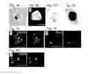 Fig. 08 - Pluripotent stem cell that can be isolated from body tissue