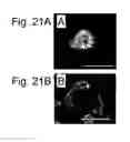Fig. 22 - Pluripotent stem cell that can be isolated from body tissue