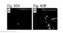 Fig. 43 - Pluripotent stem cell that can be isolated from body tissue