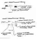 Fig. 04 - Visualization of bacterial colonization and biofilm formation on orthopaedic trauma explants