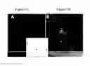 Fig. 06 - Visualization of bacterial colonization and biofilm formation on orthopaedic trauma explants