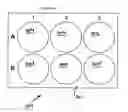 Fig. 31 - Visualization of bacterial colonization and biofilm formation on orthopaedic trauma explants