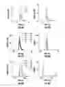 Fig. 07 - Personalized myeloma detection