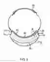 Fig. 03 - Magnifying eye goggles assembly
