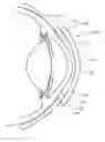 Fig. 01 - Partial corneal conjunctival contact lens