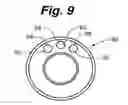 Fig. 06 - Partial corneal conjunctival contact lens