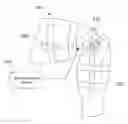 Fig. 01 - Limb immobilizing brace and system
