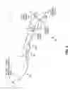 Fig. 06 - Assessment of nutrition intake using a handheld tool