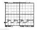 Fig. 01 - Rapid discharge circuits suitable for use in a soft-start circuit and related soft-start circuits and methods
