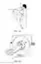 Fig. 02 - RADIATION WINDOW FOR MEDICAL IMAGING SYSTEMS