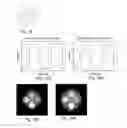 Fig. 31 - Method and apparatus of spectral differential phase-contrast cone-beam CT and hybrid cone-beam CT