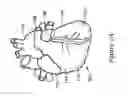Fig. 02 - Intracardiac cage and method of delivering same