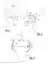 Fig. 02 - Method and apparatus for performing knee arthroplasty
