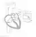 Fig. 01 - Electrosurgical device having a distal aperture
