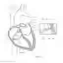 Fig. 13 - Electrosurgical device having a distal aperture