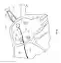 Fig. 02 - Devices and methods for ablation of tissue