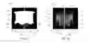 Fig. 02 - Systems and methods for anchoring and sealing a prosthetic heart valve