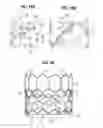 Fig. 07 - Prosthetic heart valve