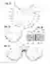 Fig. 08 - Prosthetic heart valve