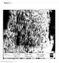 Fig. 08 - Sequential Material Deposition for Remineralization and Desensitization of Teeth
