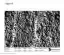 Fig. 09 - Sequential Material Deposition for Remineralization and Desensitization of Teeth