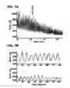 Fig. 08 - Drug treatment of overactive bladder
