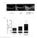 Fig. 02 - Composition comprising extract for preventing or treating short stature