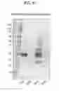 Fig. 06 - PROSTATE-ASSOCIATED ANTIGENS AND VACCINE-BASED IMMUNOTHERAPY REGIMENS