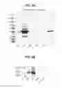 Fig. 09 - PROSTATE-ASSOCIATED ANTIGENS AND VACCINE-BASED IMMUNOTHERAPY REGIMENS