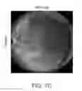 Fig. 09 - Adeno-associated virus virions with variant capsid and methods of use thereof
