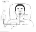 Fig. 02 - Liquid container and absorbent insert for oral negative-pressure therapy system