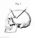 Fig. 02 - METHOD TO MAINTAIN PEACE THROUGH ELECTROMAGNETIC ENERGY TARGETED TO THE BRAIN