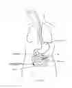 Fig. 05 - DEVICES AND METHODS FOR TREATING THE GASTROINTESTINAL SYSTEM