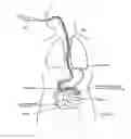 Fig. 08 - DEVICES AND METHODS FOR TREATING THE GASTROINTESTINAL SYSTEM
