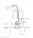 Fig. 09 - DEVICES AND METHODS FOR TREATING THE GASTROINTESTINAL SYSTEM