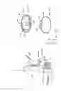 Fig. 26 - DEVICES AND METHODS FOR TREATING THE GASTROINTESTINAL SYSTEM