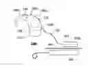Fig. 01 - Implantable hearing assistance apparatus and corresponding systems and methods