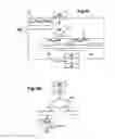 Fig. 06 - System for stimulation therapy of the vagus nerve by implementation of a state transition model