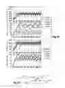 Fig. 09 - System for stimulation therapy of the vagus nerve by implementation of a state transition model