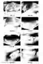 Fig. 08 - LIGHT WAVE TREATMENT INSTRUMENT AND METHODS OF USE