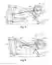 Fig. 07 - Exercise apparatus