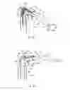 Fig. 02 - Extensible and retractable arm mechanism, and robot arm