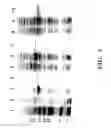 Fig. 09 - Fagopyritol synthase genes and uses thereof