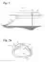 Fig. 02 - Cutter head