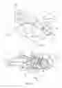 Fig. 02 - Rope tension device and method thereof
